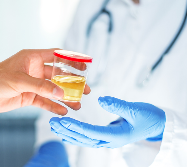 image of a urine sample for testing